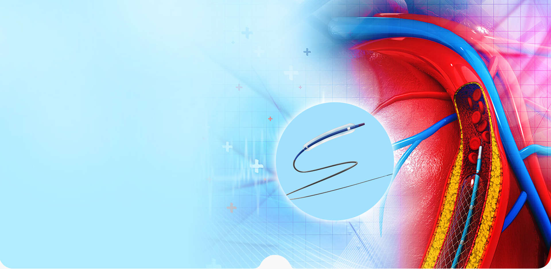 NINGBO LINSTANT POLIMERI MATERIALI CO,. LTD.