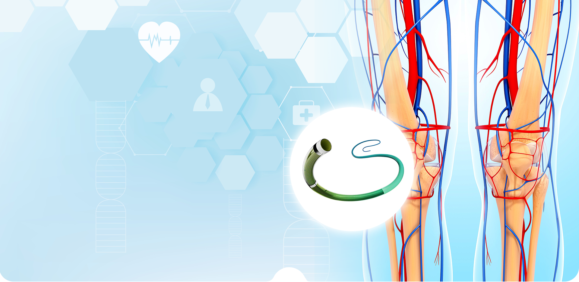 NINGBO LINSTANT POLIMERI MATERIALI CO,. LTD.